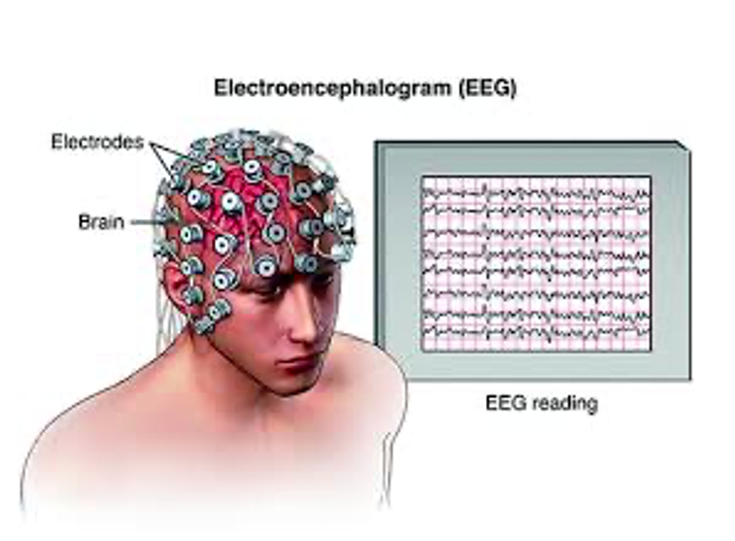 photo of eeg