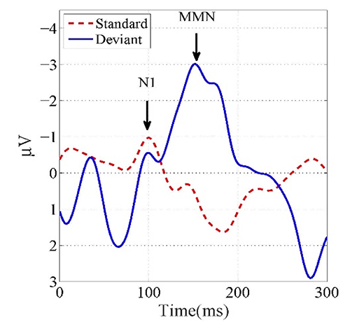 image of EEG responses to stimuli